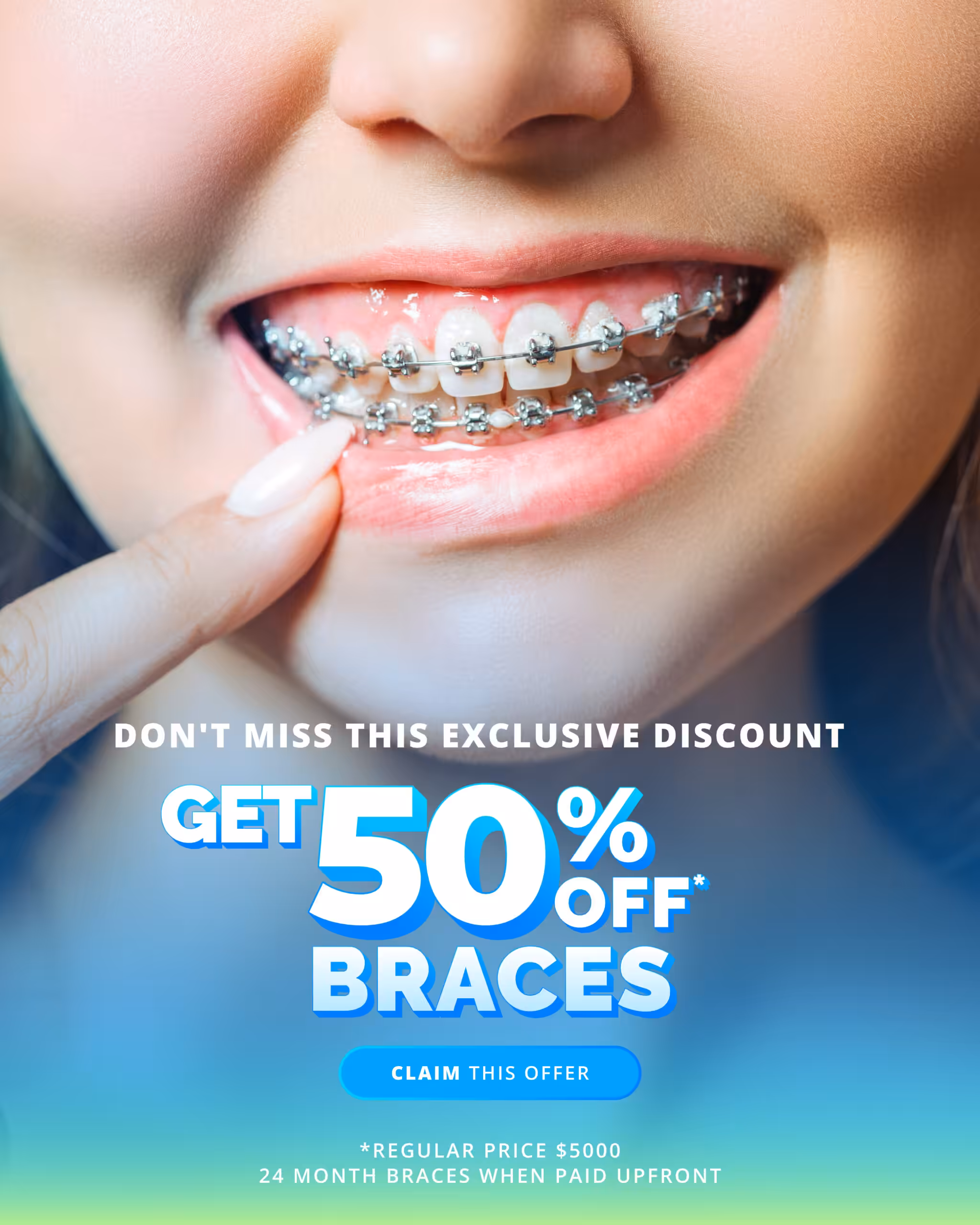 FDC MetaAds March 030325 V4 Scaled